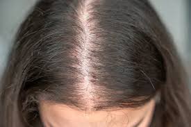 Weak & Thinning Hair